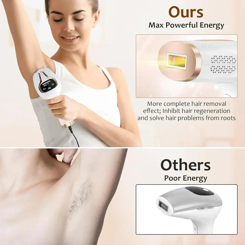 990,000 Flashes IPL Hair Removal System, Painless Laser Epilator for Women’s Body, Bikini, and Facial Areas, Permanent Hair Remo